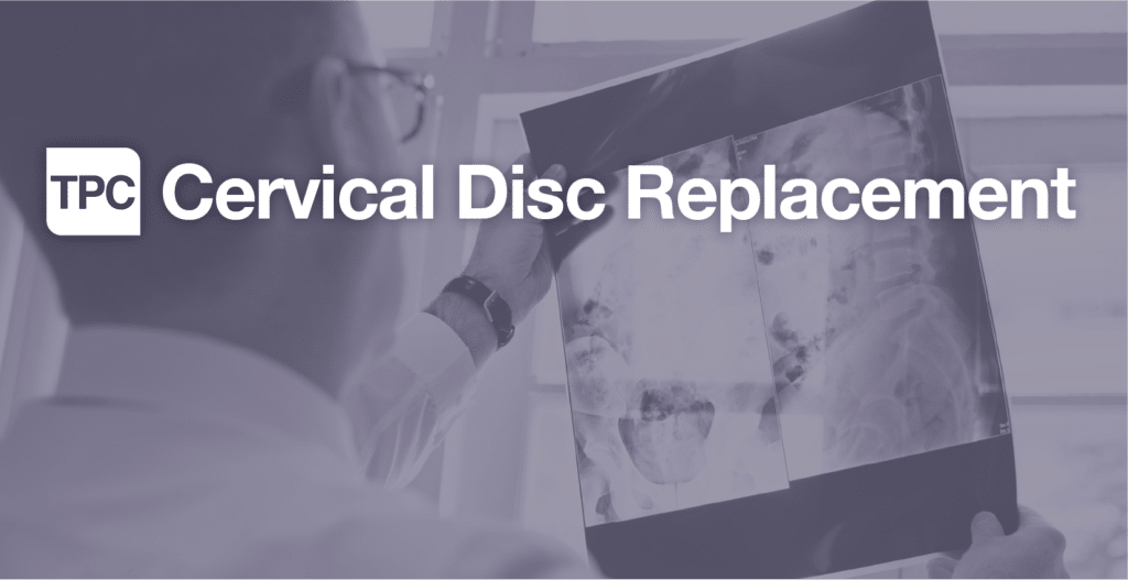 Cervical Disc Replacement