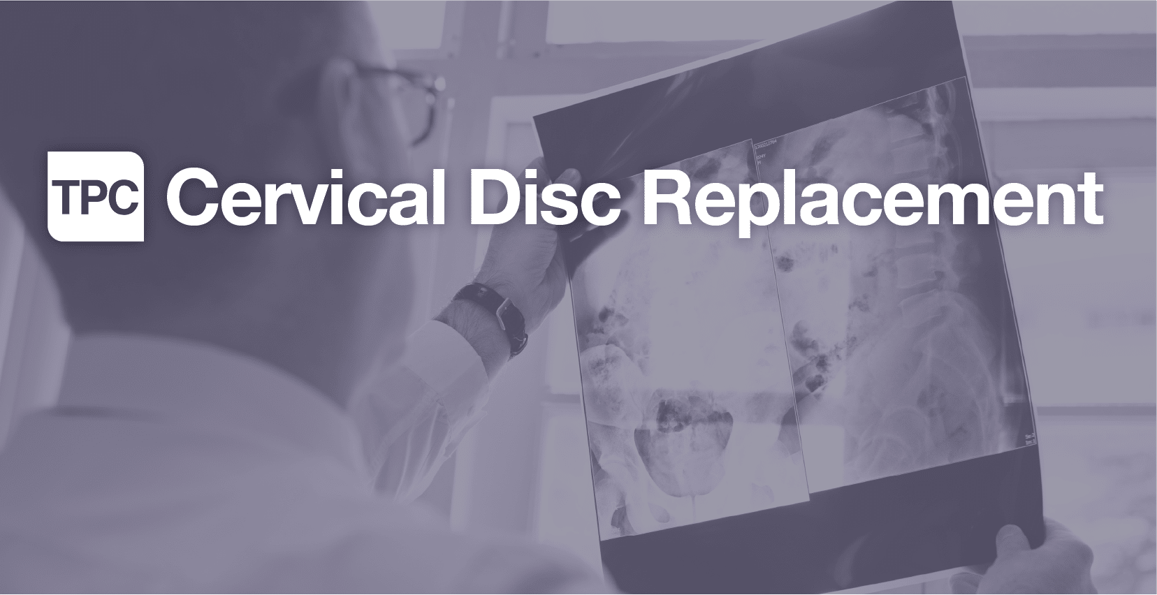 Cervical Disc Replacement The Pain Center